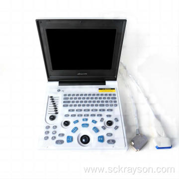 Female polycystic kidney ultrasound diagnostic instrument